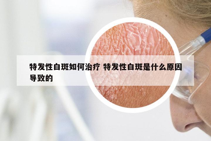 特发性白斑如何治疗 特发性白斑是什么原因导致的