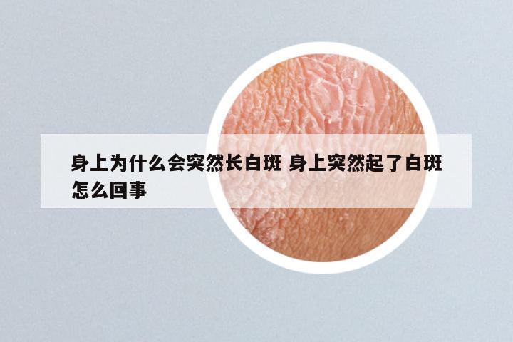 身上为什么会突然长白斑 身上突然起了白斑怎么回事