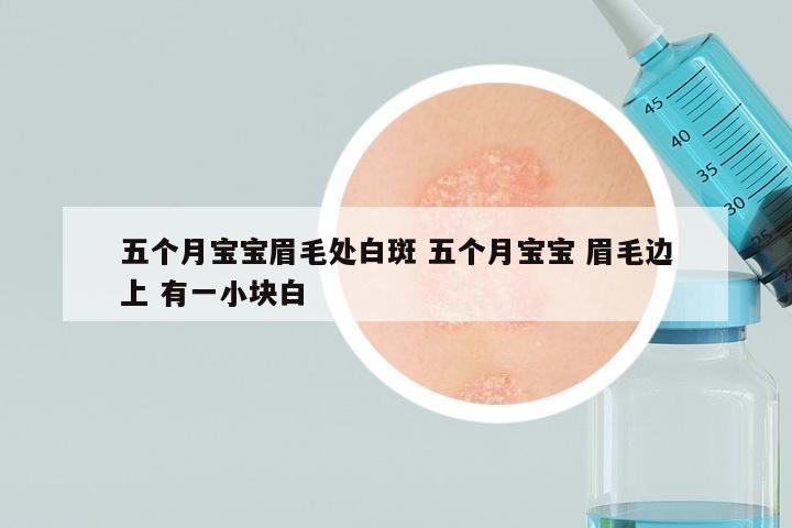五个月宝宝眉毛处白斑 五个月宝宝 眉毛边上 有一小块白