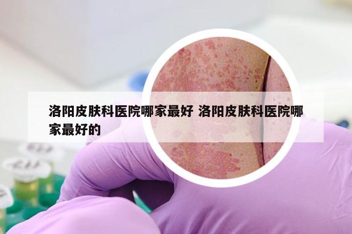 洛阳皮肤科医院哪家最好 洛阳皮肤科医院哪家最好的