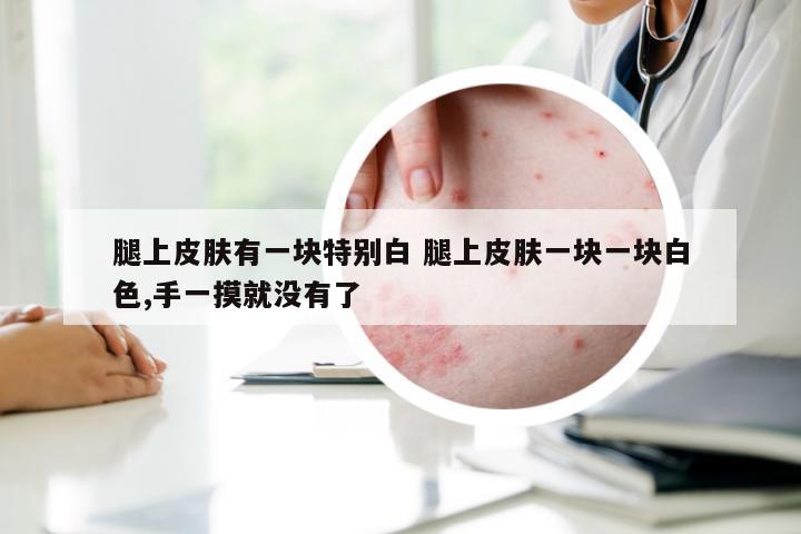 腿上皮肤有一块特别白 腿上皮肤一块一块白色,手一摸就没有了