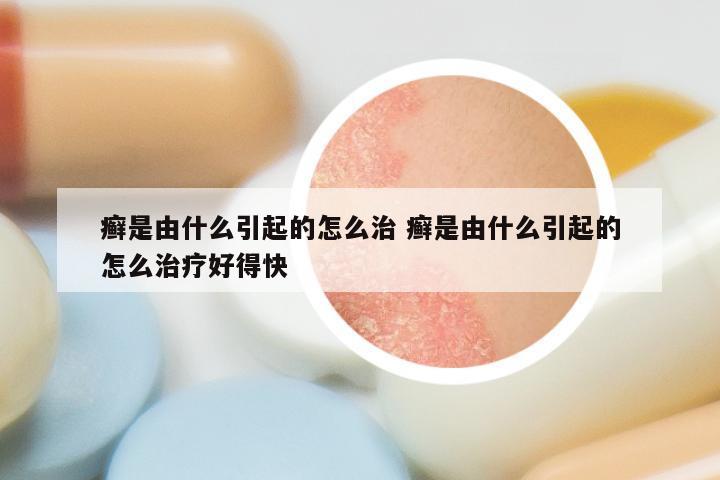 癣是由什么引起的怎么治 癣是由什么引起的怎么治疗好得快