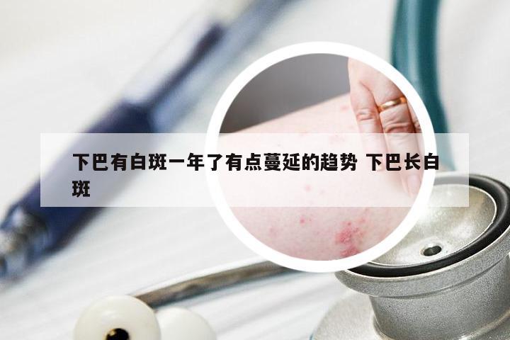 下巴有白斑一年了有点蔓延的趋势 下巴长白斑