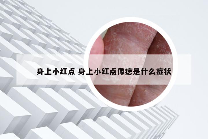 身上小红点 身上小红点像痣是什么症状