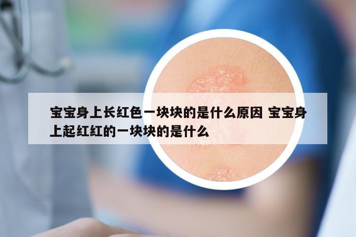 宝宝身上长红色一块块的是什么原因 宝宝身上起红红的一块块的是什么