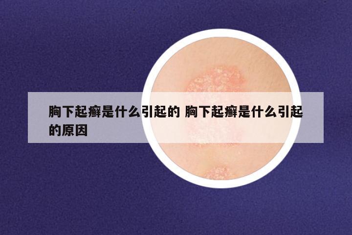 胸下起癣是什么引起的 胸下起癣是什么引起的原因