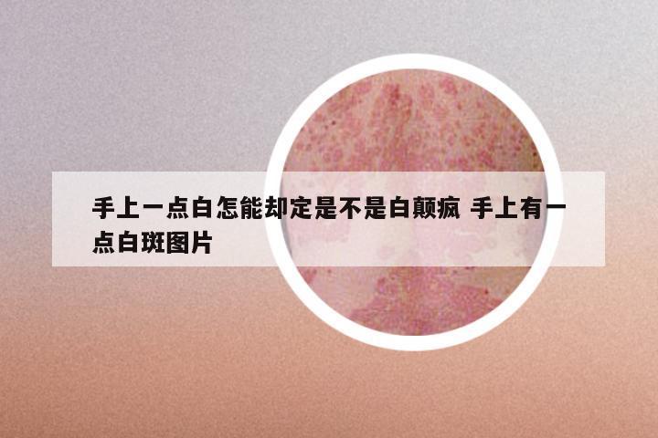 手上一点白怎能却定是不是白颠疯 手上有一点白斑图片