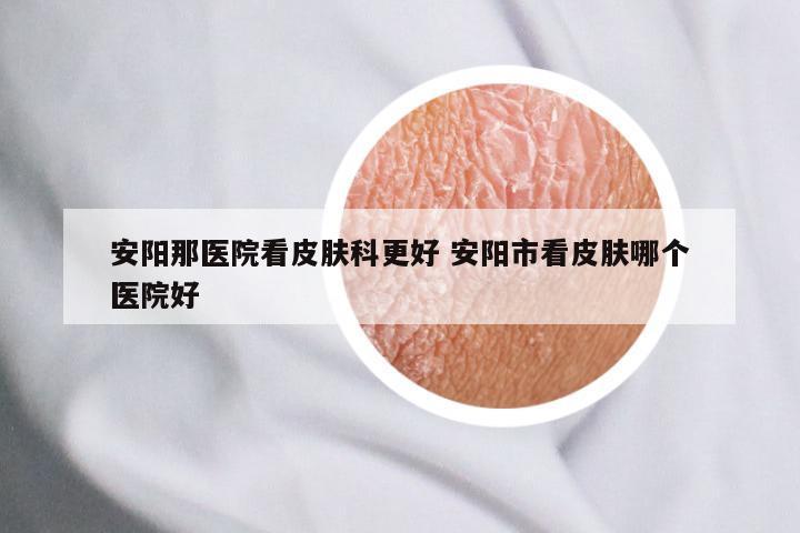 安阳那医院看皮肤科更好 安阳市看皮肤哪个医院好