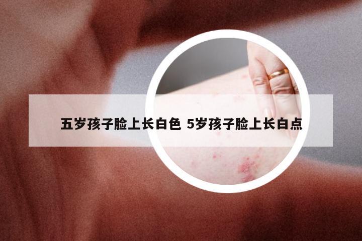 五岁孩子脸上长白色 5岁孩子脸上长白点