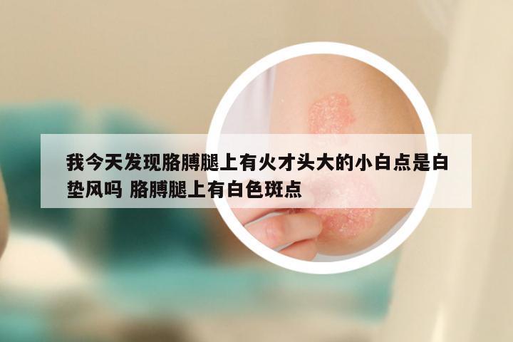 我今天发现胳膊腿上有火才头大的小白点是白垫风吗 胳膊腿上有白色斑点