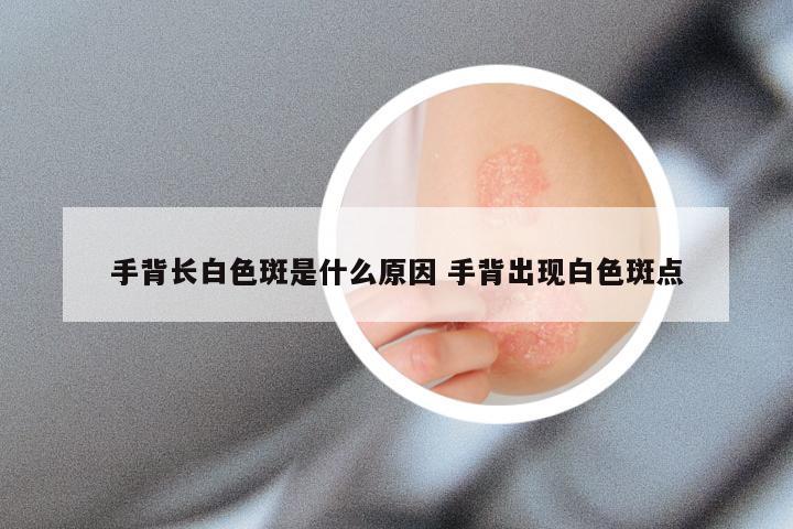 手背长白色斑是什么原因 手背出现白色斑点