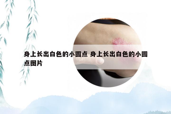 身上长出白色的小圆点 身上长出白色的小圆点图片