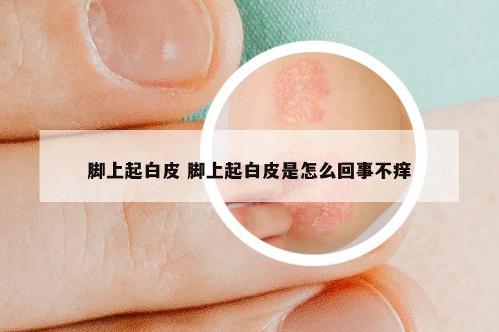 脚上起白皮 脚上起白皮是怎么回事不痒