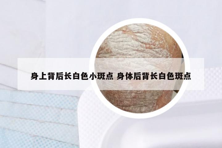 身上背后长白色小斑点 身体后背长白色斑点