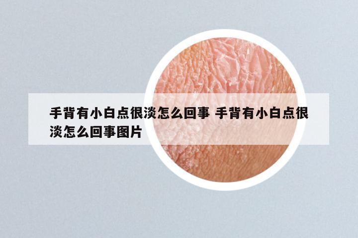 手背有小白点很淡怎么回事 手背有小白点很淡怎么回事图片