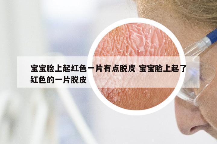 宝宝脸上起红色一片有点脱皮 宝宝脸上起了红色的一片脱皮