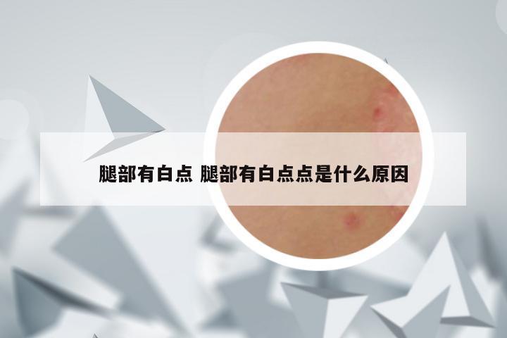 腿部有白点 腿部有白点点是什么原因