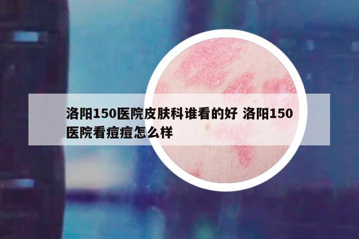 洛阳150医院皮肤科谁看的好 洛阳150医院看痘痘怎么样