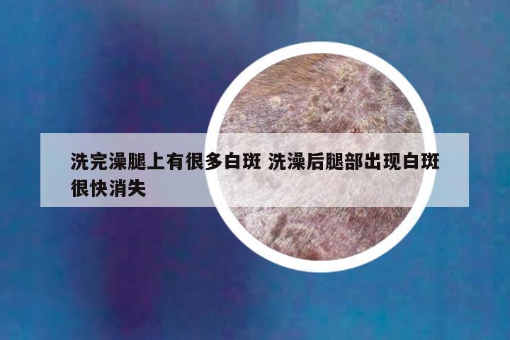 洗完澡腿上有很多白斑 洗澡后腿部出现白斑很快消失
