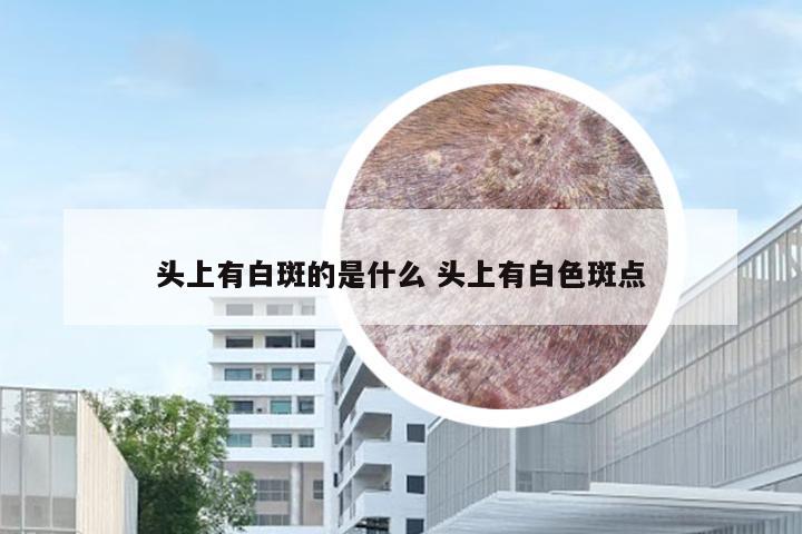 头上有白斑的是什么 头上有白色斑点