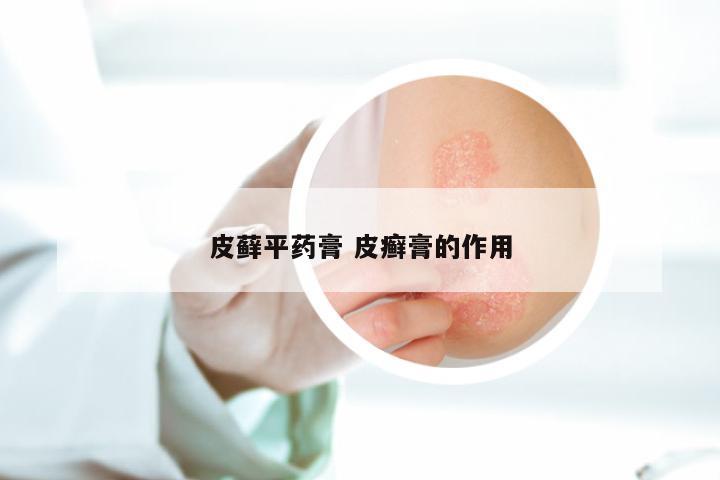 皮藓平药膏 皮癣膏的作用