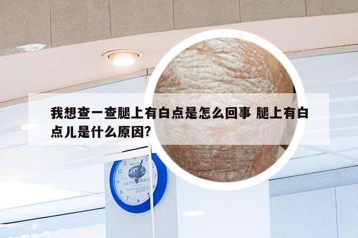 我想查一查腿上有白点是怎么回事 腿上有白点儿是什么原因?