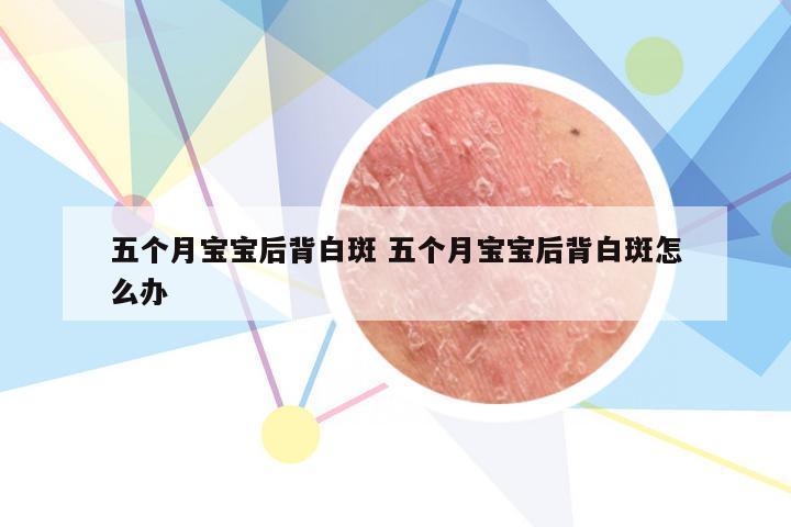 五个月宝宝后背白斑 五个月宝宝后背白斑怎么办