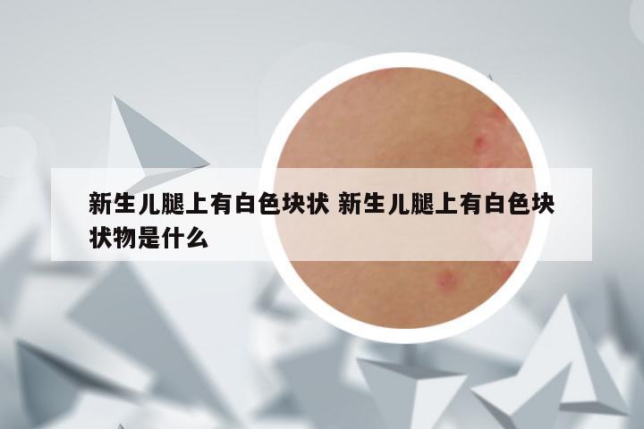 新生儿腿上有白色块状 新生儿腿上有白色块状物是什么