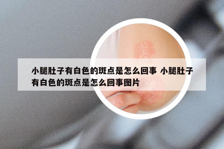 小腿肚子有白色的斑点是怎么回事 小腿肚子有白色的斑点是怎么回事图片