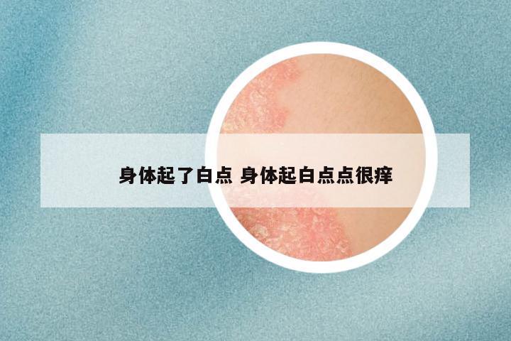 身体起了白点 身体起白点点很痒