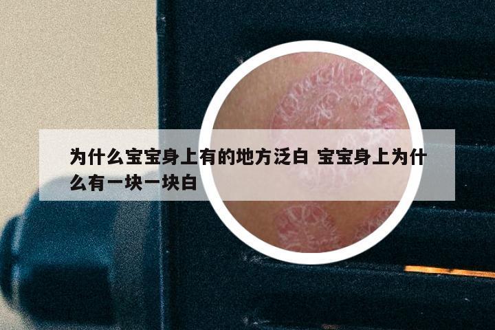 为什么宝宝身上有的地方泛白 宝宝身上为什么有一块一块白