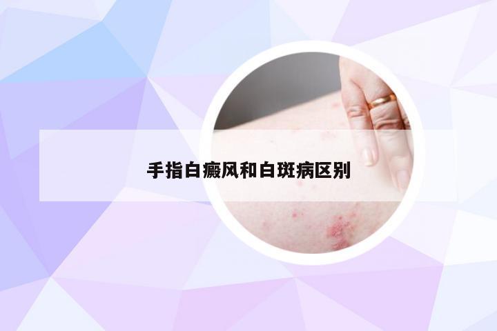 手指白癜风和白斑病区别
