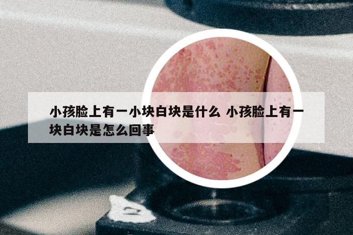小孩脸上有一小块白块是什么 小孩脸上有一块白块是怎么回事
