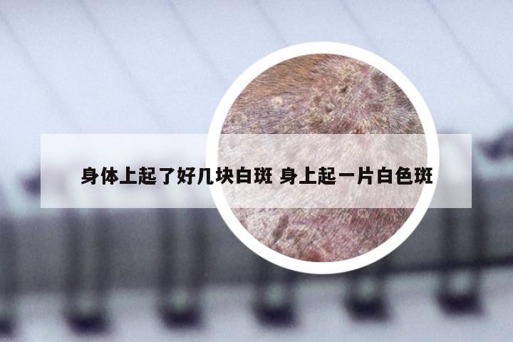 身体上起了好几块白斑 身上起一片白色斑