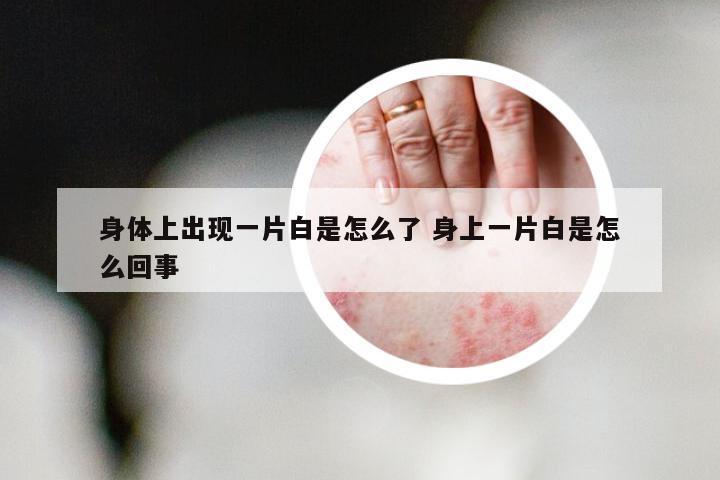 身体上出现一片白是怎么了 身上一片白是怎么回事