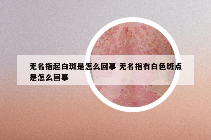 无名指起白斑是怎么回事 无名指有白色斑点是怎么回事