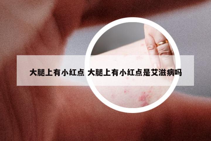 大腿上有小红点 大腿上有小红点是艾滋病吗
