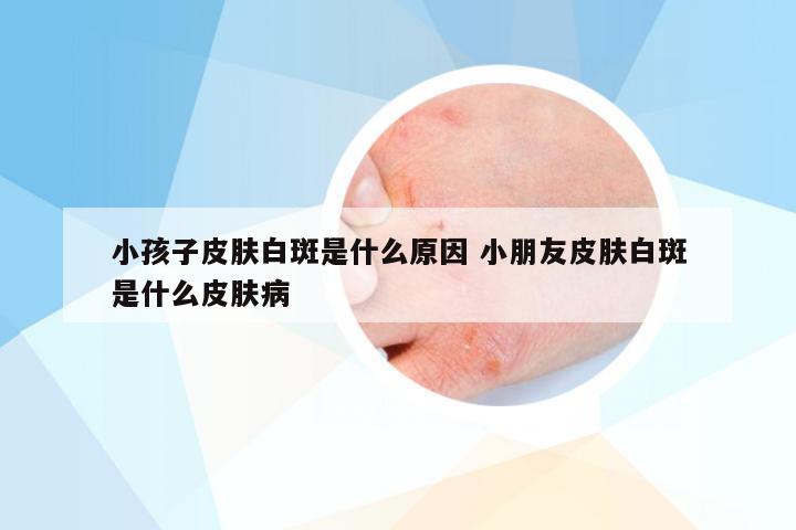 小孩子皮肤白斑是什么原因 小朋友皮肤白斑是什么皮肤病