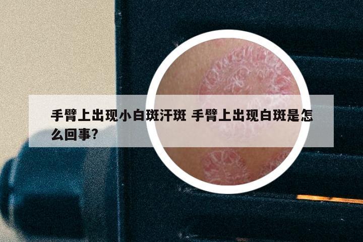 手臂上出现小白斑汗斑 手臂上出现白斑是怎么回事?