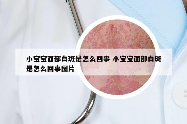 小宝宝面部白斑是怎么回事 小宝宝面部白斑是怎么回事图片