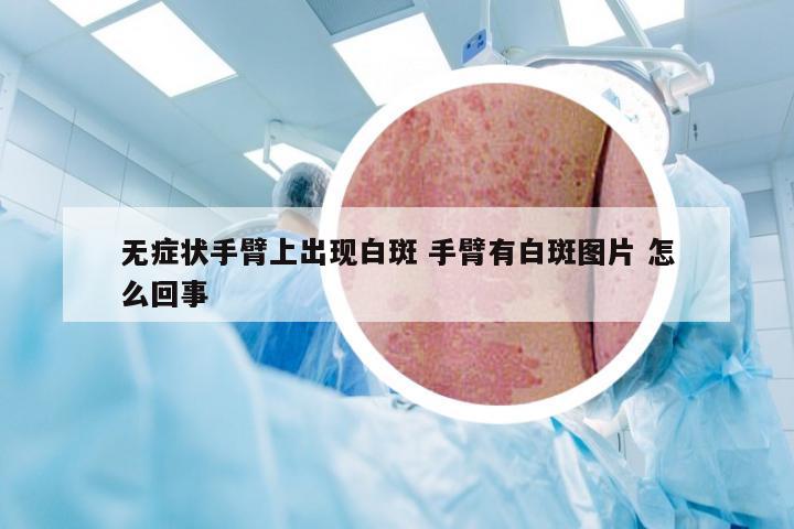 无症状手臂上出现白斑 手臂有白斑图片 怎么回事