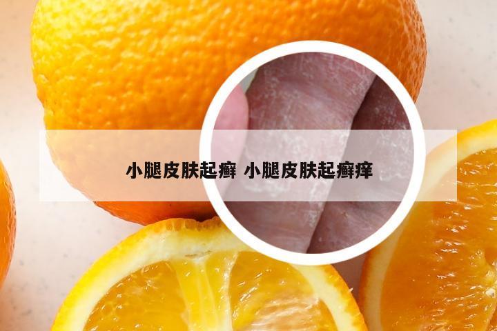小腿皮肤起癣 小腿皮肤起癣痒