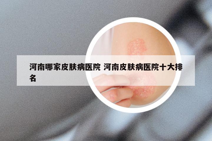 河南哪家皮肤病医院 河南皮肤病医院十大排名
