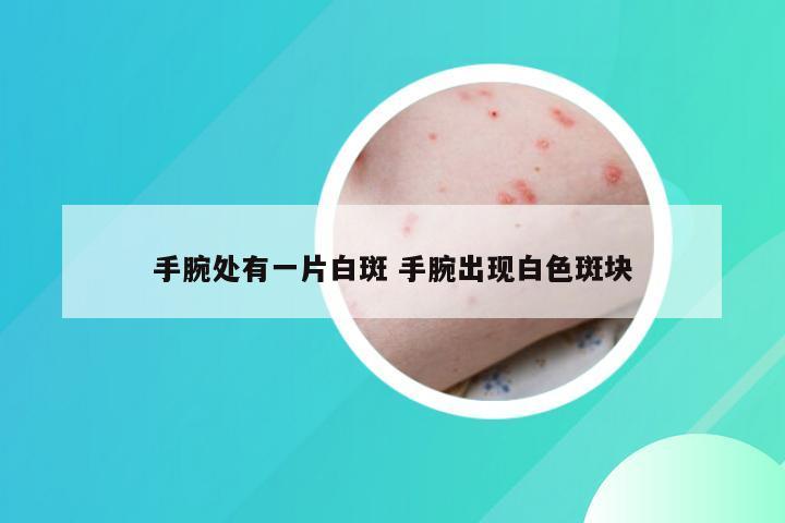 手腕处有一片白斑 手腕出现白色斑块