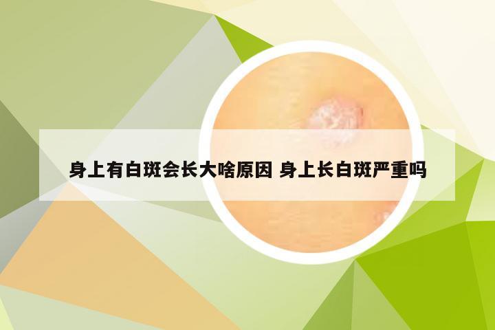 身上有白斑会长大啥原因 身上长白斑严重吗