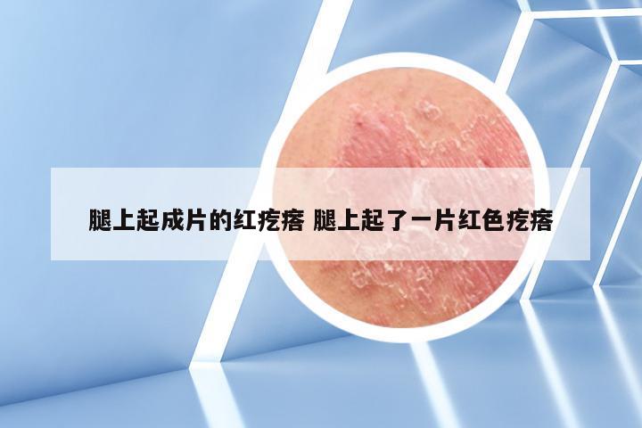 腿上起成片的红疙瘩 腿上起了一片红色疙瘩