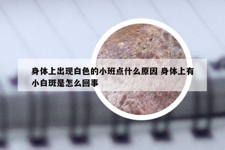 身体上出现白色的小班点什么原因 身体上有小白斑是怎么回事