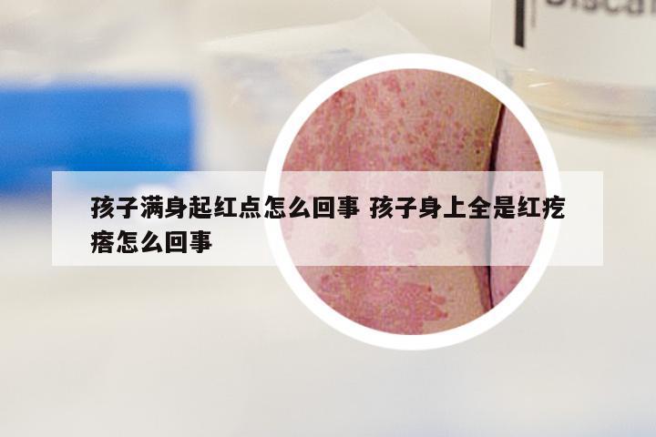孩子满身起红点怎么回事 孩子身上全是红疙瘩怎么回事
