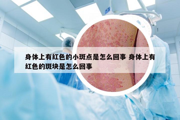 身体上有红色的小斑点是怎么回事 身体上有红色的斑块是怎么回事