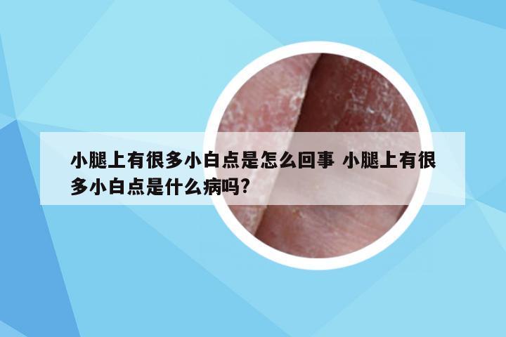 小腿上有很多小白点是怎么回事 小腿上有很多小白点是什么病吗?